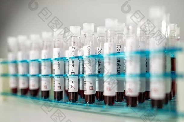 积极的结果电晕病毒测试血测试管特殊的持有人实验室