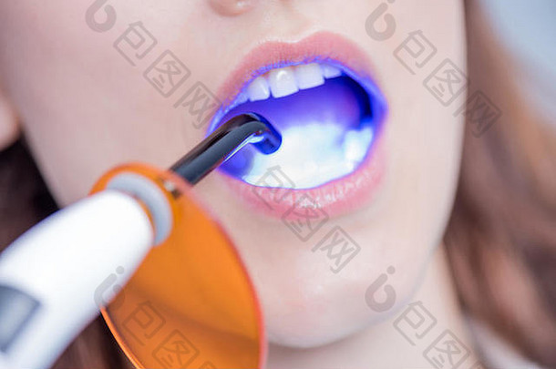 裁剪拍摄病人牙齿治愈牙科固化光