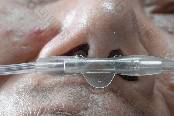 上了年纪的女人鼻呼吸管呼吸