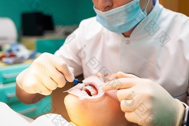 病人脸颊牵开器谎言牙科椅子过程牙齿美白