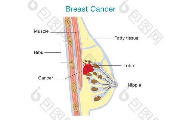 增长乳房癌症细胞女人