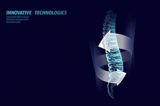 人体脊柱损伤物理治疗保护。疼痛区外科手术护理现代腰医学技术低多边形三角形。三维渲染返回