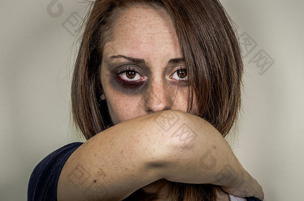悲伤的被殴打的脸上有伤口的女孩用深沉的目光看着摄像机——白种人——关于对妇女暴力的概念