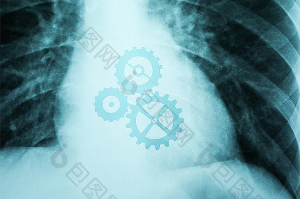 人体的X光照片显示了用齿轮工作的心脏