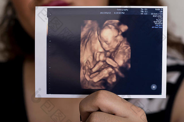 一名妇女手持未出生婴儿的超声图像，在脸前。