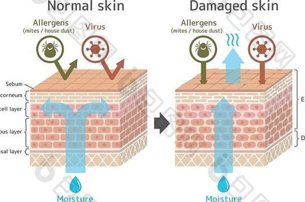 截面视图皮肤比较插图保护效果健康的皮肤受伤的皮肤