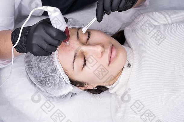 美容师做中胚层注射。<strong>微针</strong>介孔疗法。美容师的治疗妇女。硬件美容。介观疗法，皮肤保护，面部区域治疗，面部年轻化。