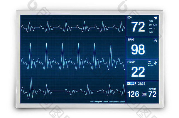 心率<strong>监控设备</strong>渲染插图医疗保健技术