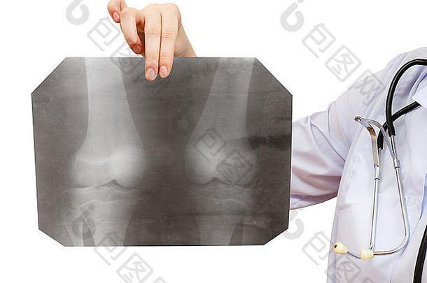 护士拿着一张X光照片，照片上的人膝关节被隔离在白色背景上