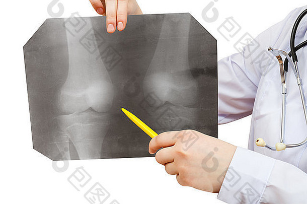在白色背景上隔离人膝关节的护士点X光照片