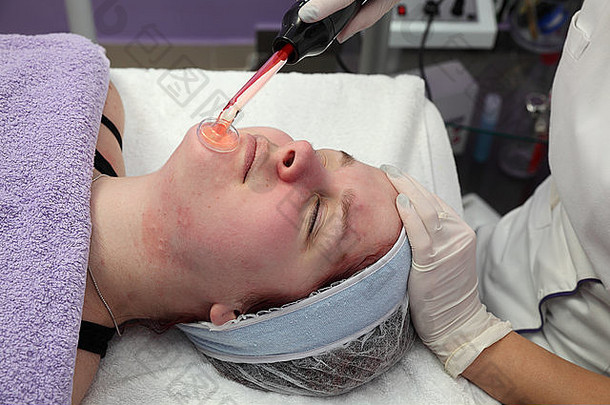 水疗中心高频红外祛斑剂美容面部肌肤