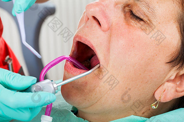 牙科治疗期间，坐在牙医椅上张嘴的老年妇女