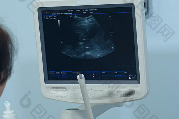 女妇科医生检查胎儿生活超声波扫描仪