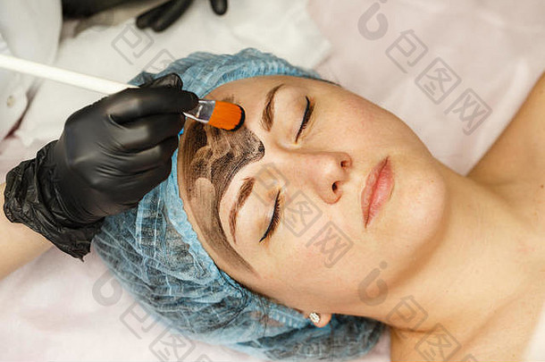 美容师将碳纳米凝胶涂在客户面部的皮肤上。皮肤激光治疗的准备。碳面剥离。