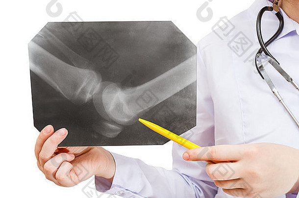 护士显示x射线图片人类膝盖联合孤立的白色背景