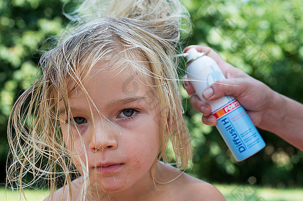 吮吸虱子的治疗——儿童金发小女孩带虱子的头发