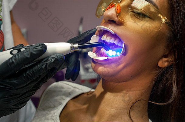 戴手套的牙医用光聚合灯和扩张器治疗年轻女子的牙齿。闭合。