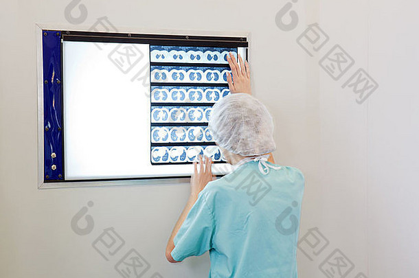 女医生检查x射线图像病人