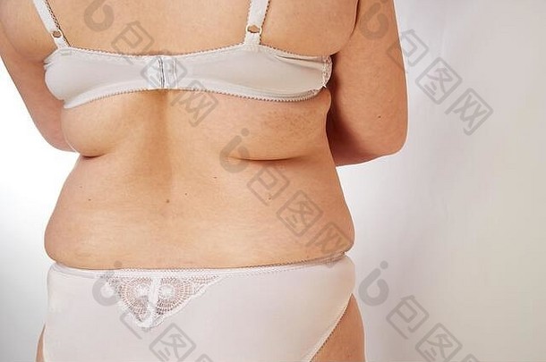 岁的超重女人显示脂肪折叠回来白色孤立的背景概念医学美容