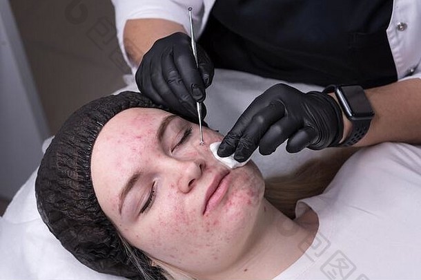 过程机械脸清洁美沙龙年轻的模型化妆品脸皮<strong>肤</strong>护理治疗美容师痤疮治疗水疗中心美容健康放松概念