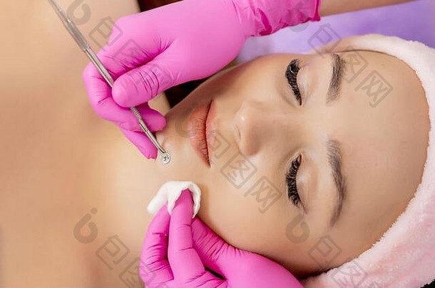 美容师水疗中心美沙龙痤疮治疗机械仪器概念医疗治疗复兴护肤品