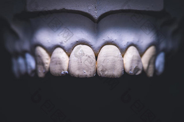 牙科假肢人工牙照片人工牙齿使牙科实验室