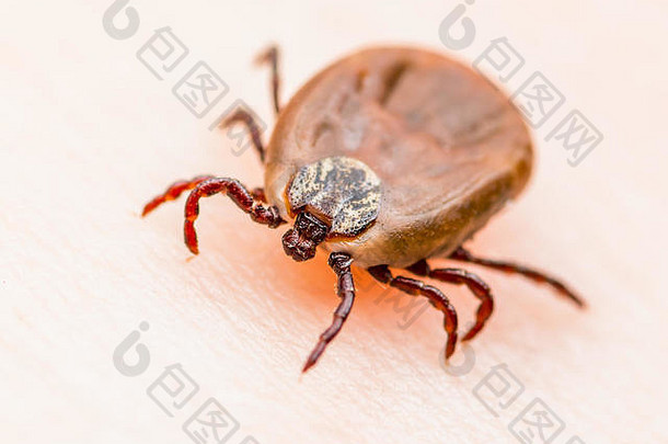 脑炎病毒莱姆疾病受感染的矩头蝉属蜱虫蛛形纲动物的昆虫皮肤宏