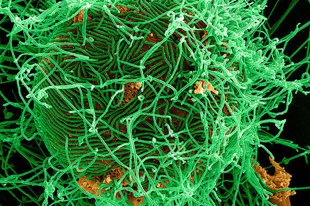 丝状埃博拉病毒病毒粒子彩色的绿色初露头角的真正细胞彩色的黄色的