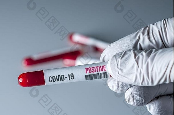 医疗手套持有管血积极的结果测试科维德冠状病毒