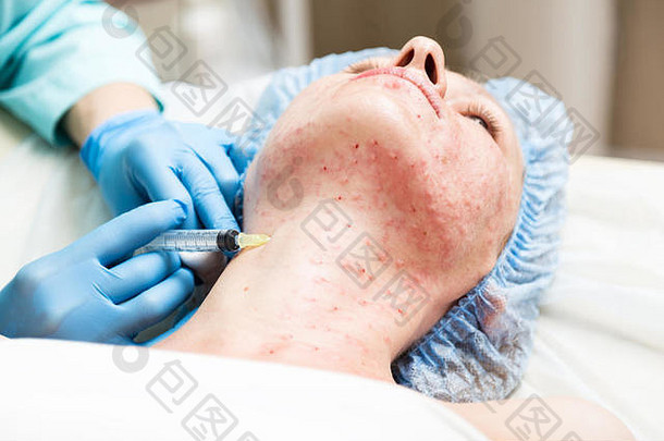 美容师使biorevitalization年轻的女人化妆品程序脸美治疗水疗中心沙龙面部皮肤护理