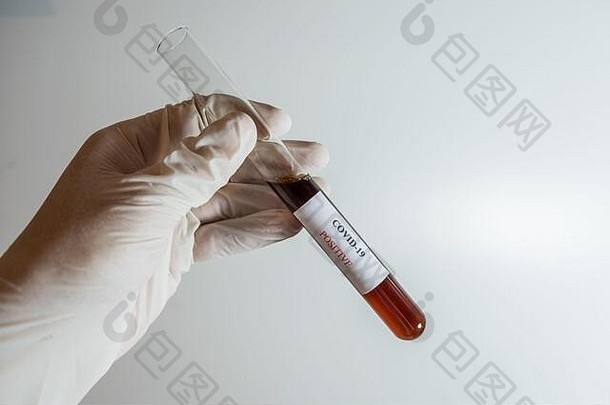 血测试结果冠状病毒