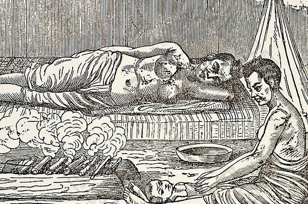 古董医疗插图显示劳动分娩原始的文化