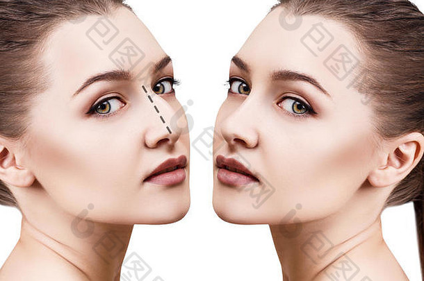 女鼻子化妆品手术