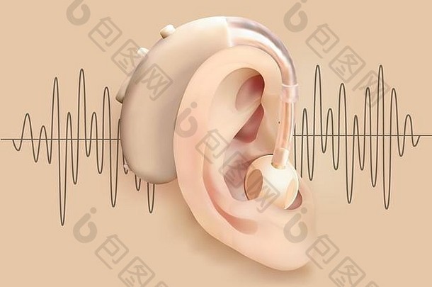 听力援助耳朵耳朵声音放大器背景声音波模式耳聋听力损失治疗假肢