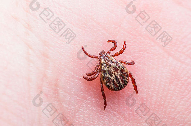 脑炎病毒莱姆疾病受感染的蜱虫蛛形纲动物的昆虫皮肤