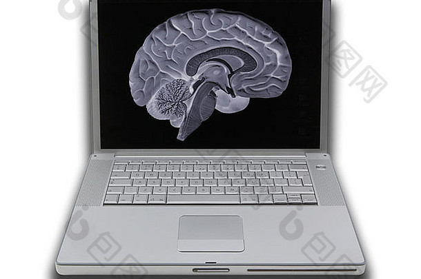 腿上前可移植的电脑屏幕显示图片片雷x光x射线人类大脑