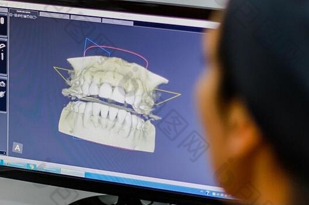 牙医分析图像