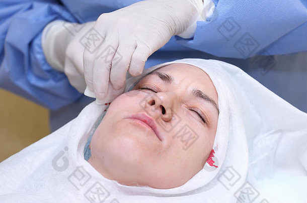 过程脸提升手术
