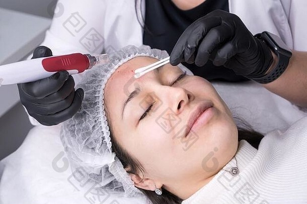 美容师使消脂注射微针消脂治疗女人美容师硬件美容消脂德马彭治疗脸区脸复兴