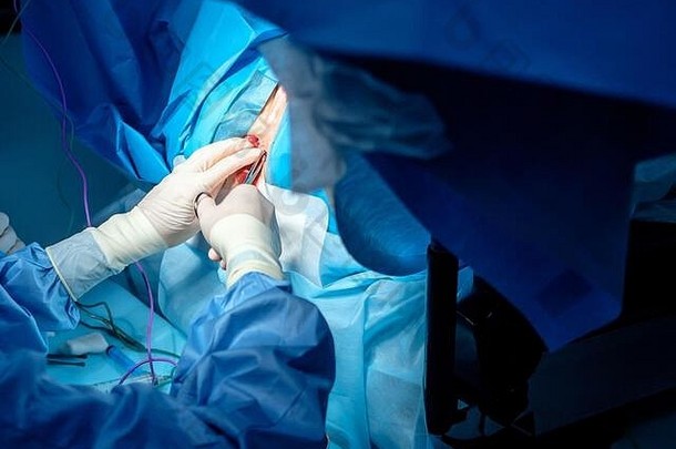 浑身是血手外科医生无菌乳胶手套外科手术仪器痕迹血过程执行外科手术肛肠科