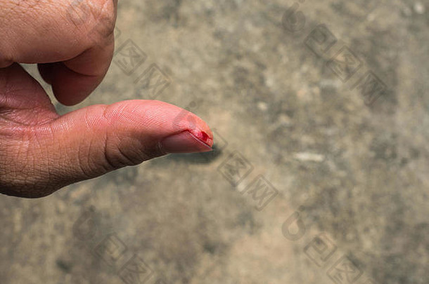 左拇指血流引起的估计谨慎的修复管道