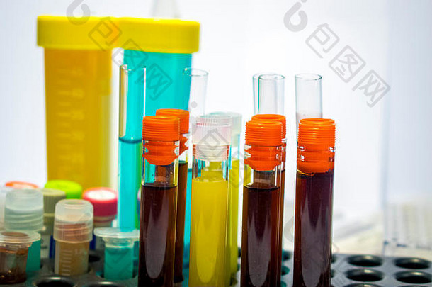 色彩斑斓的实验室测试管生物化学血测试尿液测试测试管医疗分析研究概念生育能力研究阀杆细胞