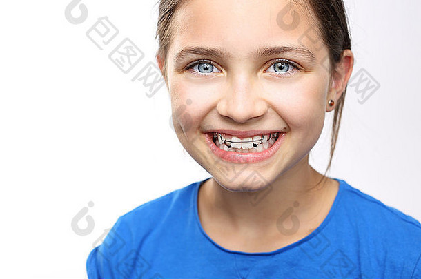 孩子矫正设备健康的美丽的微笑孩子牙医口腔正畸学美丽的微笑