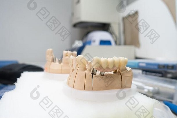 工作场所牙科技术员制造牙科假体植入物