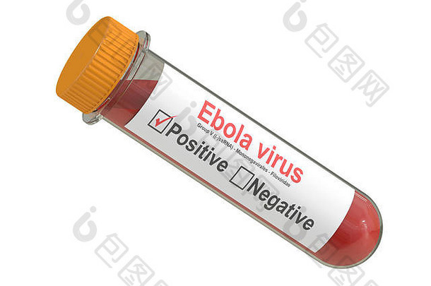 测试管血样本积极的埃博拉病毒病毒呈现