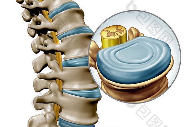 腰椎脊柱磁盘解剖学段医疗概念关闭人类回来骨架椎放大脊髓绳磁盘