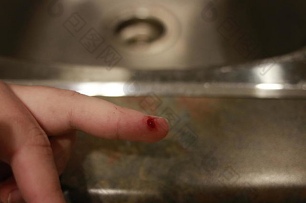 出血血减少手指伤口受伤的手指出血开放减少伤口特写镜头手指人类手减少伤害出血明亮的