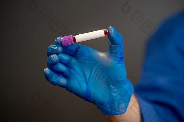 科维德医生实验室技术员科学家佩普个人保护设备持有血样本管受感染的病人医院科罗纳韦