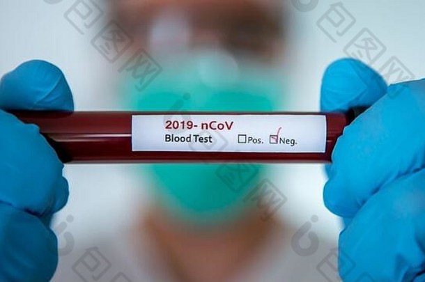 医疗保健援助复苏科维德科学家穿外科手术手套面具负冠状病毒受感染的血样本测试科学家