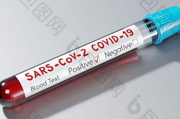 冠状病毒萨尔斯科夫科维德病毒测试管血测试插图